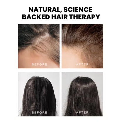 TheraBrush™ Hair Therapy Tool